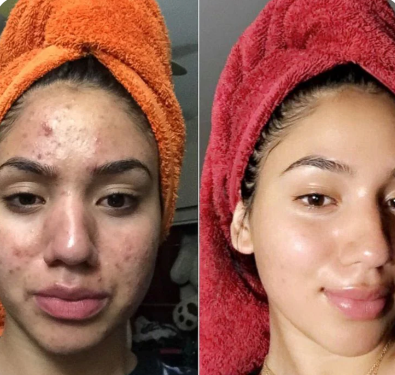 Rice Peel Glow Serum