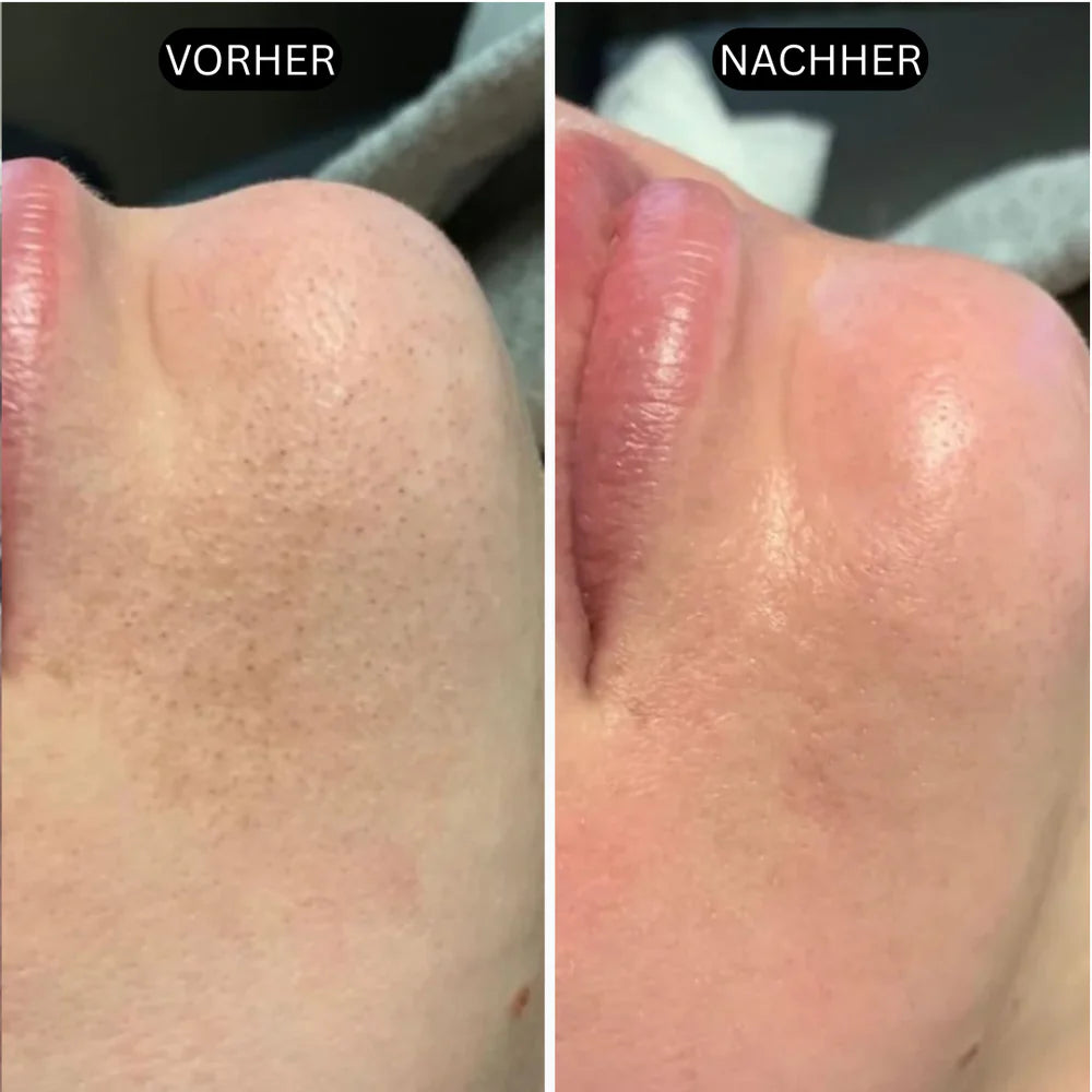 Rice Peel Glow-Serum