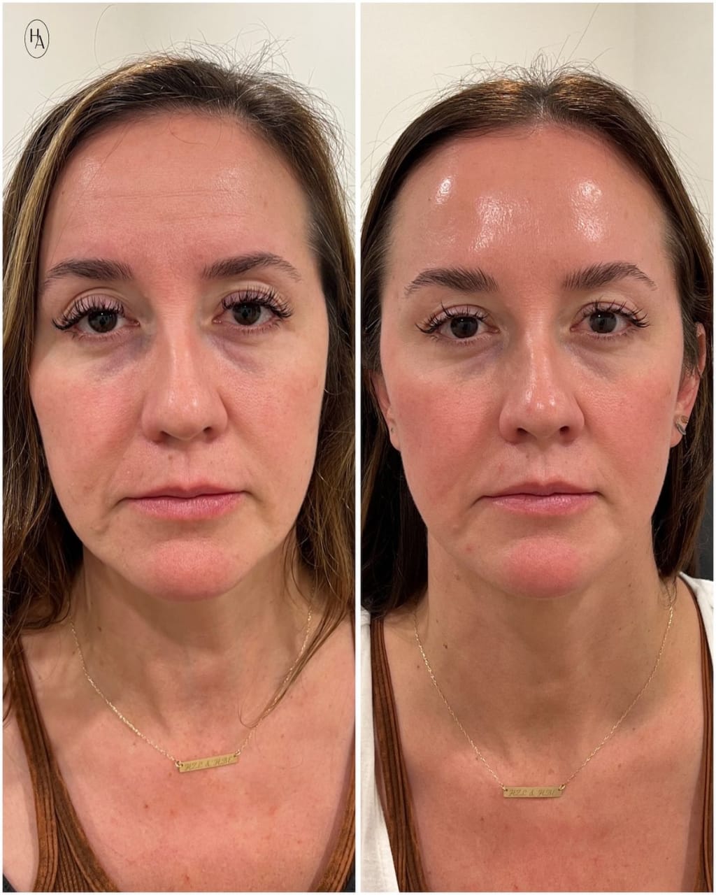 Rice Peel Glow Serum