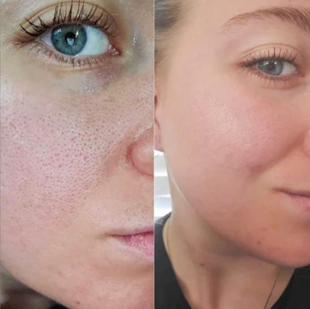 Rice Peel Glow Serum