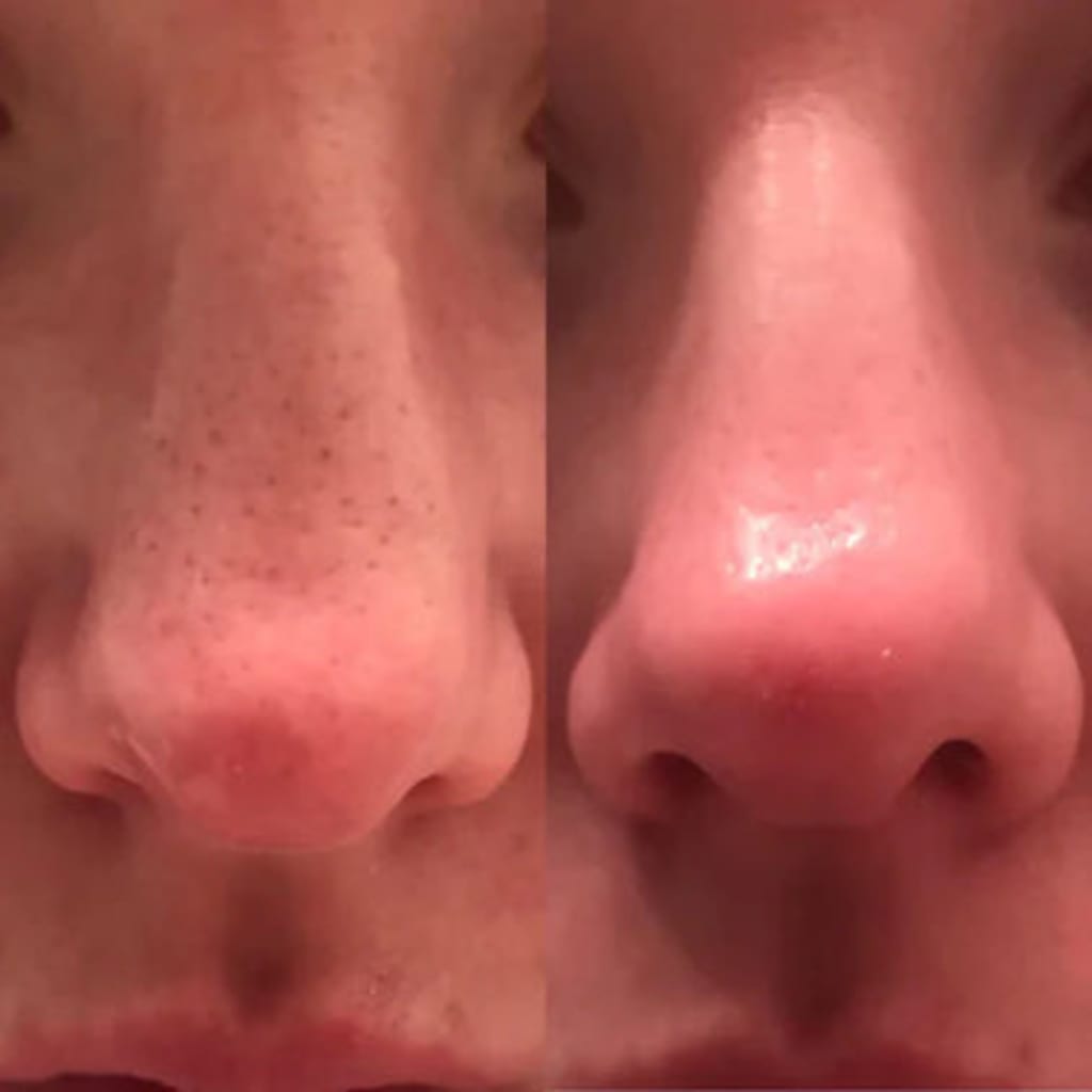 Rice Peel Glow Serum
