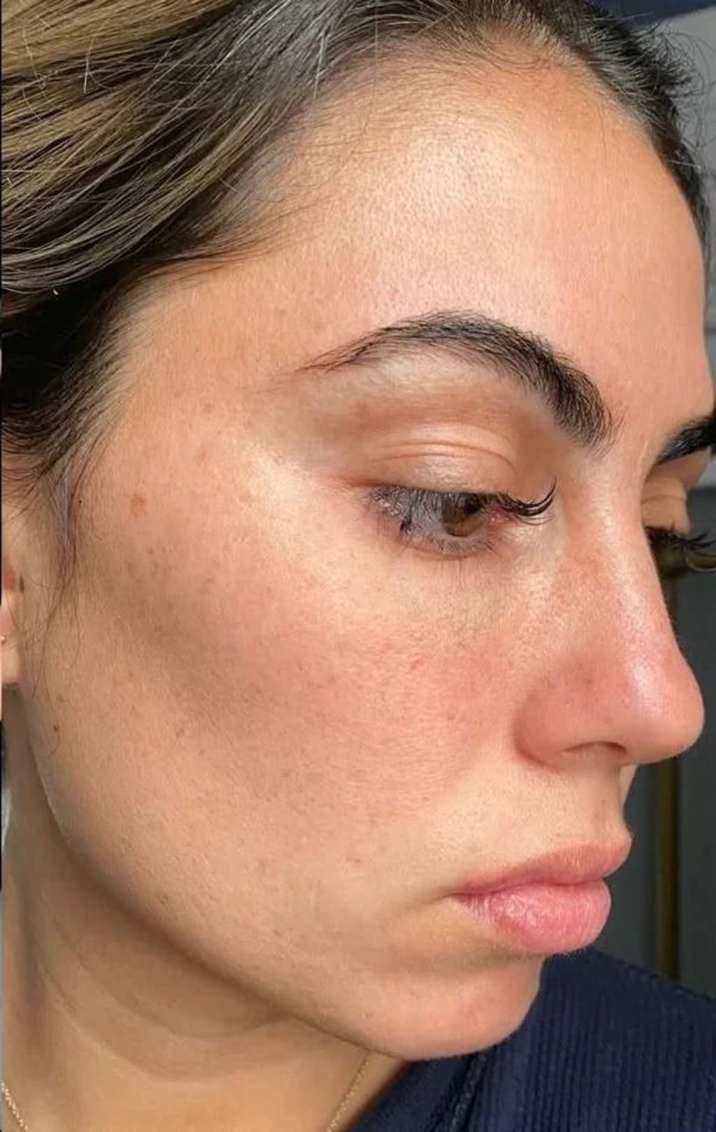 Rice Peel Glow Serum