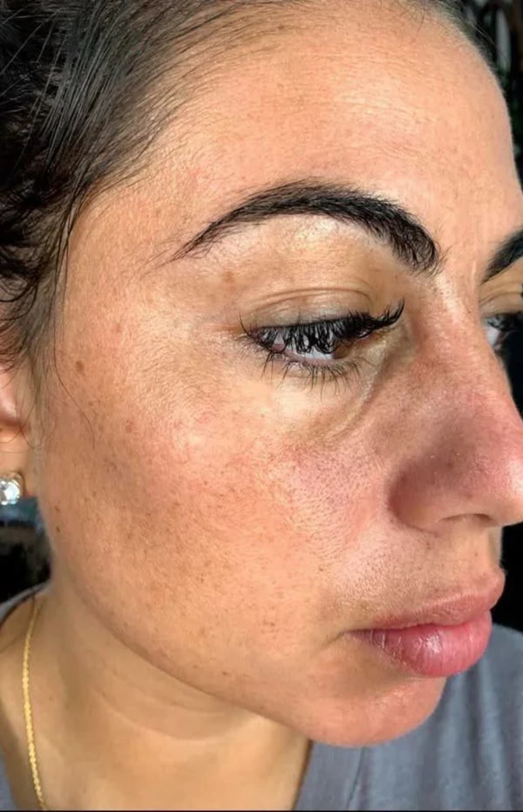 Rice Peel Glow Serum