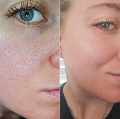 Rice Peel Glow Serum